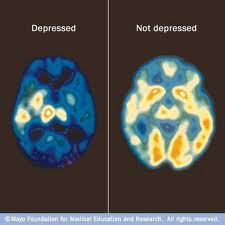 Diagnostisering