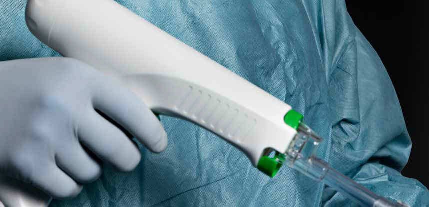 Pulsed Lavage Mölnlycke Pulsed Lavage, spolsystem med högt tryck för engångsbruk, rengör effektivt och avlägsnar benfragment under implantatinsättning, ökar