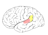 Wernickes area är den del av hörselkortex som anses särskilt viktig för talförståelsen, se figur 5.