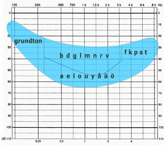 auditiv perceptuell nedsättning där olika frekvensområden påverkas på olika sätt av nedsättningen.