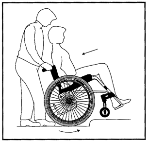 Endast vana användare ska använda den här tekniken.