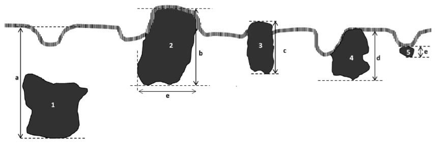 Figur PAT-5: Exempel på invasionsdjupet för adenocarcinom. Tumörer "1" "5" har invasionsdjupet a, b, c resp e.