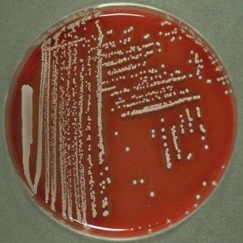 Identifiering av bakterier