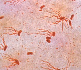 Bakterier: Salmonella typhi Gram negativ, kort stav, flageller