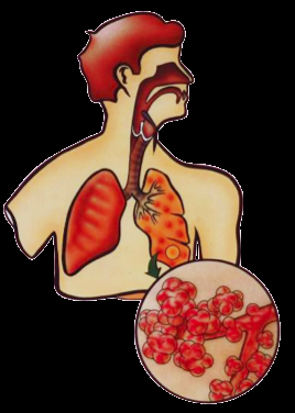Kroppens försvarsmekanism: 99% av alla svetsrökpartiklar når lungorna!