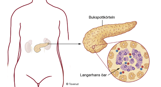 Bukspottkörteln- reglerar blodsocker nivån i blodet I bukspottkörteln finns små grupper av hormonbildande celler (kallas Langerhans öar) Langerhans öar bildar hormonerna insulin