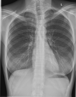 8. Lungparenkym Normal