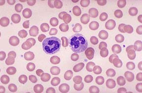 5(7) Metodkarakteristika Interferenser och felkällor Vid användning av EDTA-blod kan vissa morfologiska avvikelser som ökad vakuolisering, förändrad cellkärneform och degranulering förekomma.