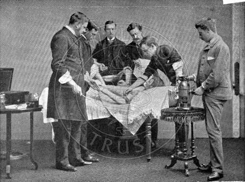 Dödligheten efter amputation var hög enligt den skotska professorn i kirurgi, Joseph Lister dog sexten ut av 35 patienter under åren 1864-1866. På andra lasarett kunde dödligheten vara ännu högre.