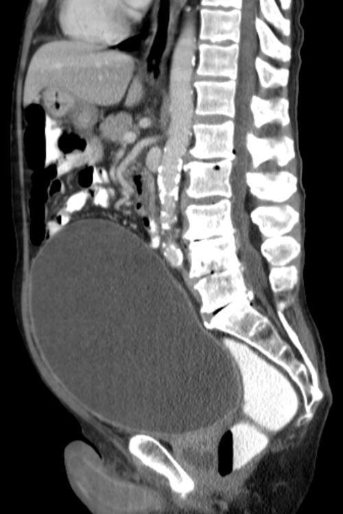 Diagnos?