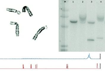 A C 600 400 200 95 tripletter 244 275 299 421 3 000 2 000 1 000 539 Figur 1. Olika sätt att diagnostisera fragil X-syndromet. A.