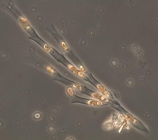 Klassificeringen av en sjös näringsstatus enligt Naturvårdverkets metod (Naturvårdsverket 27) görs på juli- eller augustiprov genom en sammanvägning av följande parametrar: totalbiomassa av