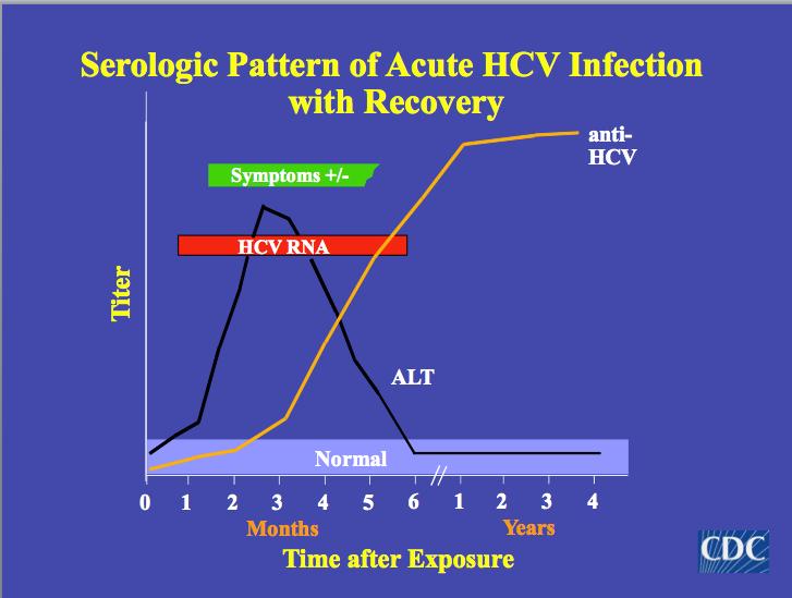 Akut Hepatit C: