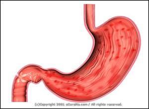 Mag- tarmdiagnoser samt produkter Diagnos Beskrivning Symptom Magkatarr Den medicinska diagnosen gastrit kallas också i folkmun för magkatarr.