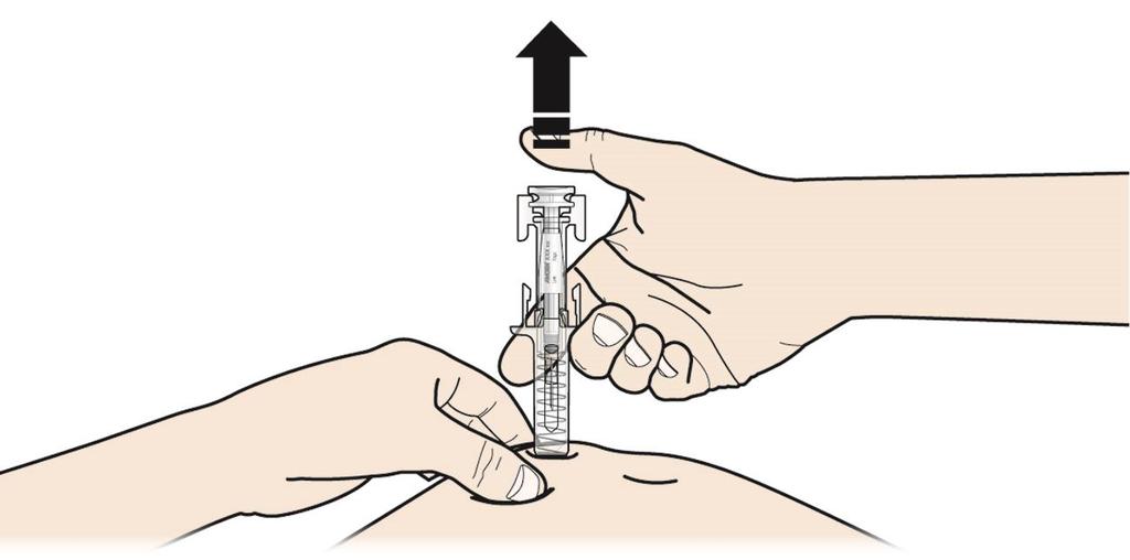 KLICK Det är viktigt att trycka igenom klicket för att hela dosen ska injiceras. C SLÄPP tummen.