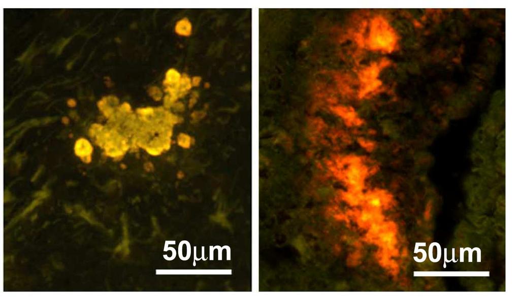 Immunoglobulins Transthyretin High-Density Lipoprotein