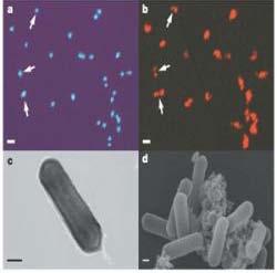 bacteria (AOA and AOB) NH