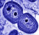 Nitrification Nitrification involves several reactions and two different bacteria: 1. Dissociation of ammonium 2.