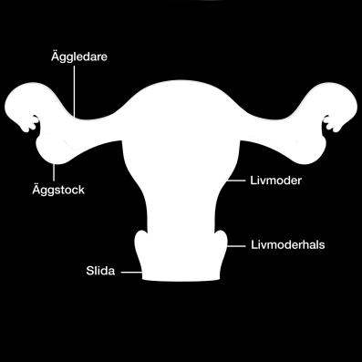 Hysterektomi och OPPortunistisk SAlpingektomi (Borttagande av äggledare i samband med livmoderoperation) Vill du vara med i en studie som undersöker om äggledarna ska tas bort eller inte i samband