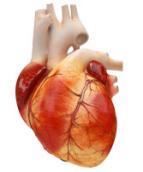Patologi Coronar 3-kärlssjukdom - Virchow s triad Endotelskada Stört blodflöde Framförallt viktig hjärta och artärer där högt blodflöde annars skyddar mot bildandet av proppar. Ex.