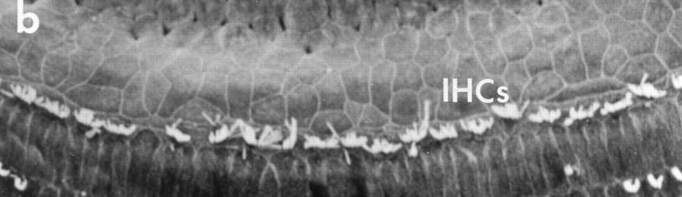 ossicles, inflammation in the middle ear.