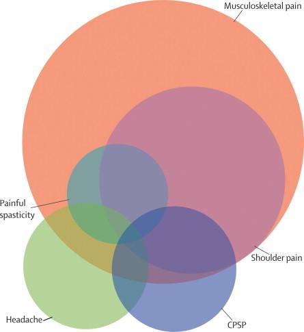 Central post-stroke pain: clinical characteristics, pathophysiology, and