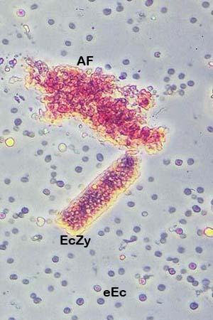 Erytrocytcylindar