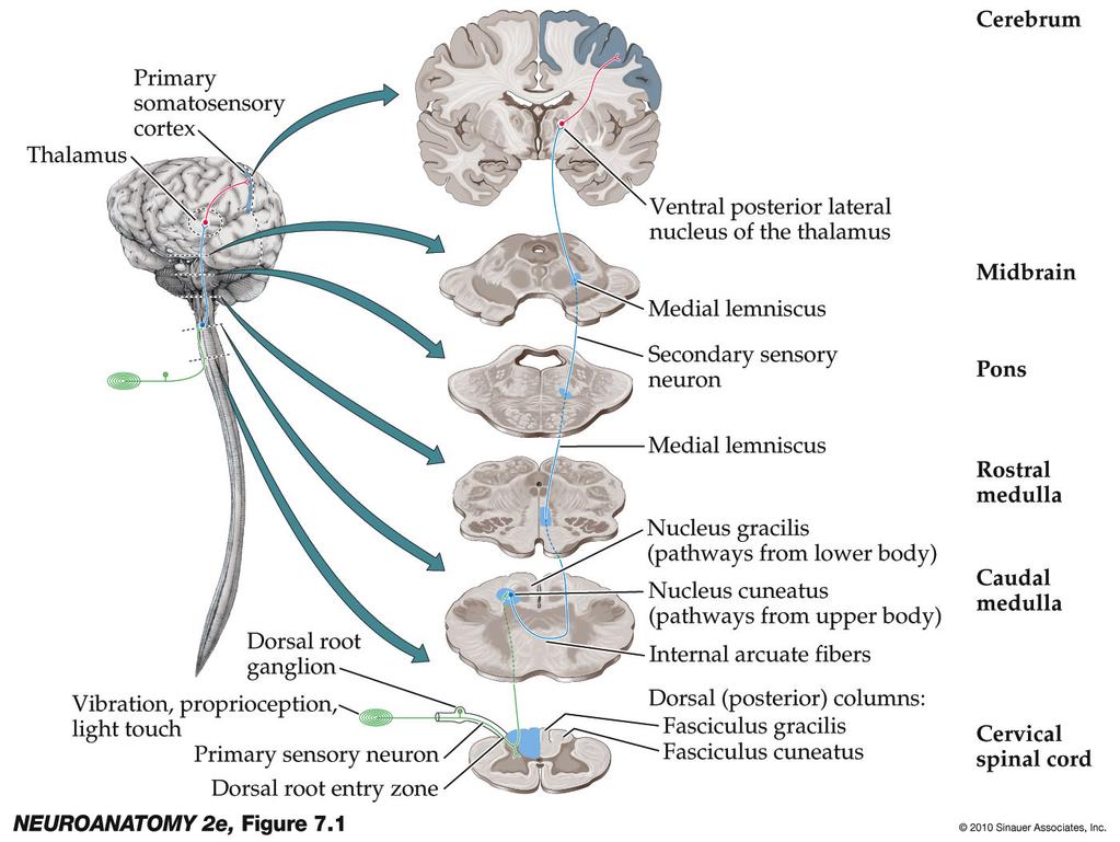 Proprioception, baksträngsbanan Börjar i de perifera nerverna Polyneuropati Fortsätter upp