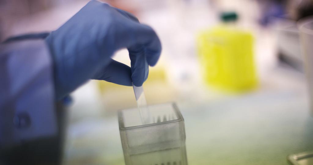 VERKSAMHETSBESKRIVNING NORINVENT AB (PUBL) Medicinteknik inom Life Science XtriG Ny beredning och administration NorInvent har för avsikt att utveckla en ny teknik för hur läkemedelstillverkare kan