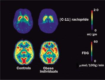 Fysiologiskt motstånd Adipose cellularity Endocrine function Energy metabolism Neural responsivity Addiction-like neural mechanisms Anastasiou, C. A., Karfopoulou, E., & Yannakoulia, M. (2015).