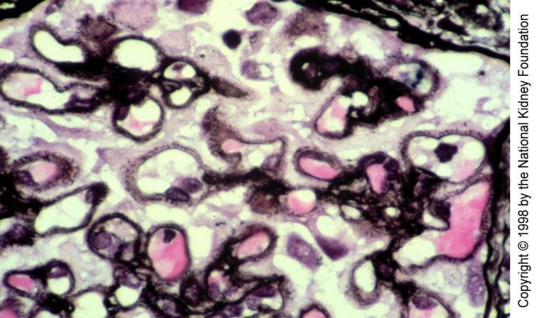 forts Cirkulerande IgG antikroppar riktas mot endogena antigen på eller nära