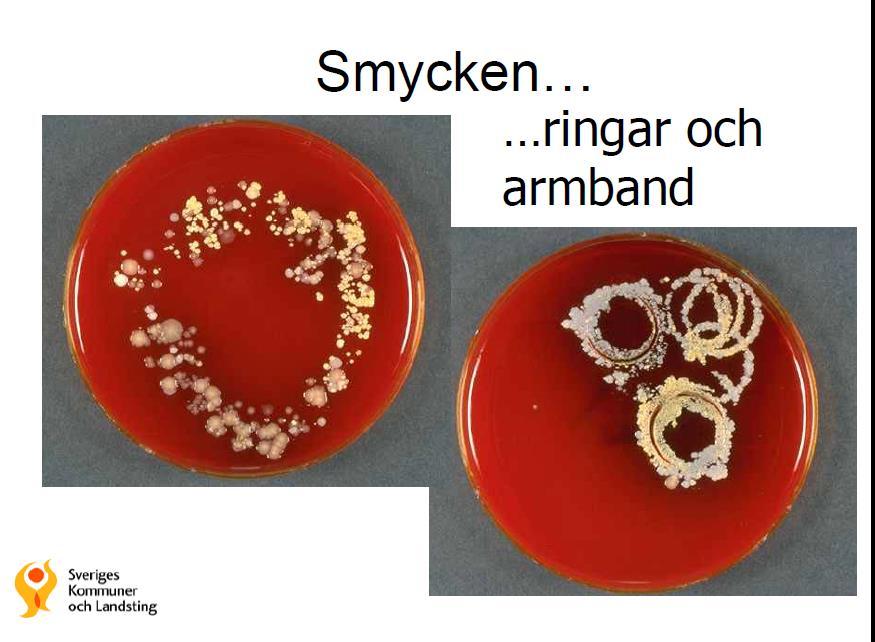 Fem fingrar Efter