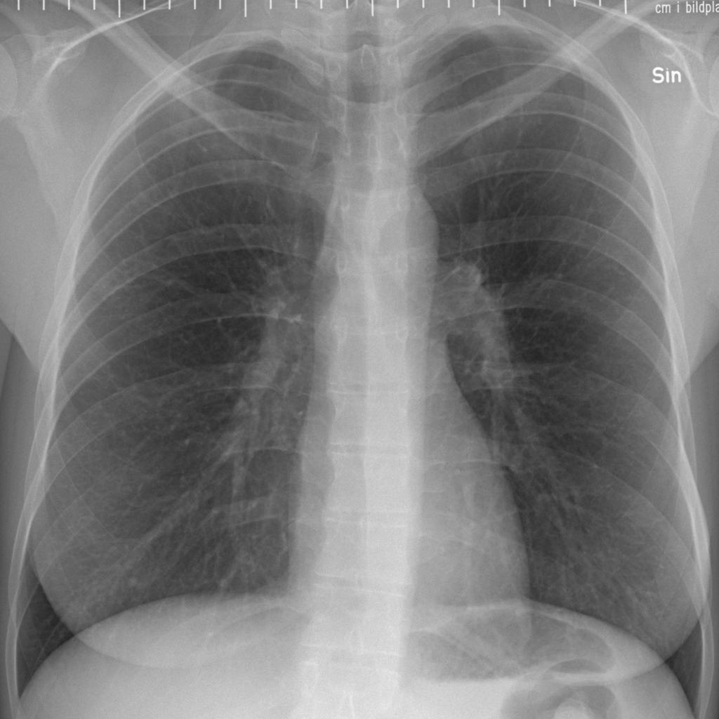 lung bild