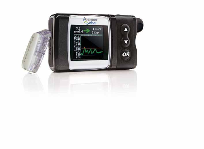Insulinpumpen Animas Vibe med Dexcom G4 PLATINUM Vad händer när man kombinerar marknadens mest användarvänliga insulinpump 1 med det bästa CGM*-systemet?