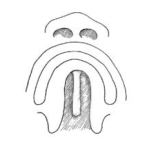 plastkirurg, specialisttandläkare, logoped, ÖNH-läkare (audiolog/foniater), kurator och omvårdspersonal. Psykolog, genetiker och barnläkare kan också ingå i teamet.