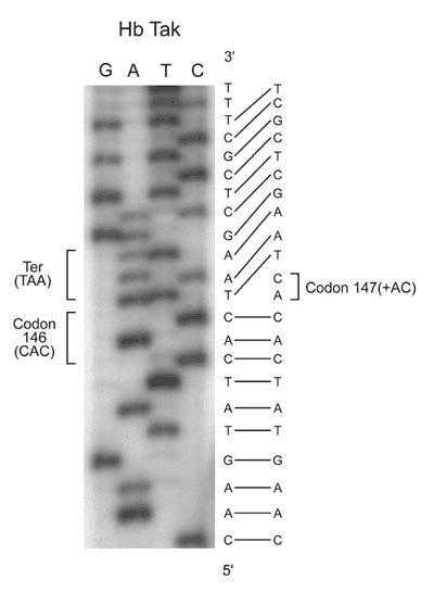 Fosfor inmärkning av DNA/RNA, fosforylering av protein 32 15 P P: 23 kända isotoper Vanlig lab-isotop : - 32 P β sönderfall -t 1/2 ca 16.