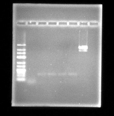 4.3 PCR Eftersom det inte var möjligt att klyva ut inserten med BamHI och EcoRI utfördes PCR för att söka efter inserten.