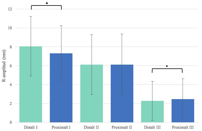 3. Resultat 3.1. Kalibrering Tio oberoende mätningar av 10 mm (1 mv) kalibreringssignal på EKG mättes med digitalt skjutmått.