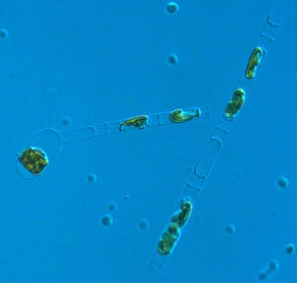 The diatom Chaetoceros wighamii was at BY2 in the