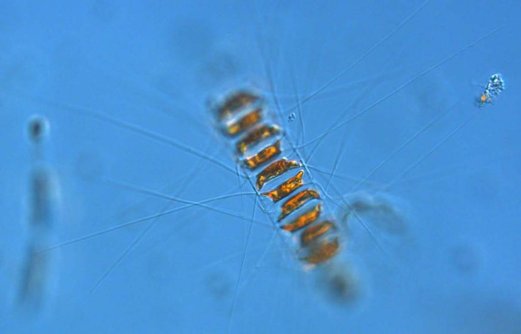 This Skeletonema marinoi cyst like cell was found