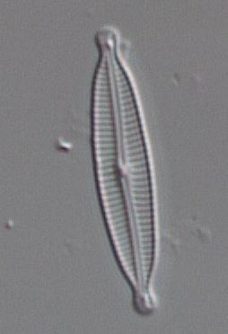 tiga vatten och som förekom på många lokaler i undersökningen är bl.a. Encyonema neogracile, Encyonopsis subminuta (Figur 4), Fragilaria gracilis, Gomphonema exilissimum, Microcostatus maceria,