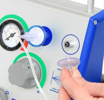 applying able fibrin solutions for sealant FörInTISSEEL lösningar vävnadslim och ARTISS lösningar vävnadslim using a pressure device, maximum