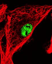 TRANSPORT AV VIRUS INUTI CELLEN Höljelösa DNA-viruset (CPV) transporteras i cellvesiklerna till nucleus: Cytoplasm!