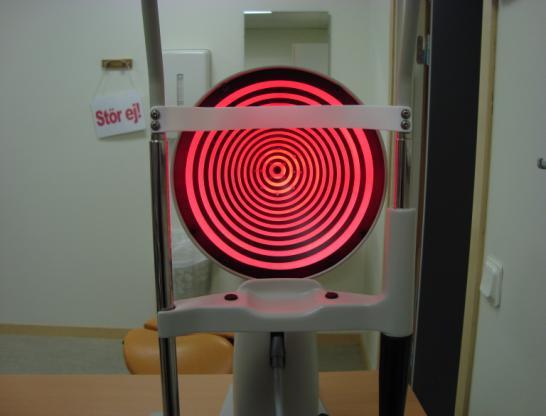 Keratometri, fotokeratoskopi och videokeratoskopi använder tårfilmen som en konvex spegel och låter koncentriska ringar återspeglas på patientens öga, se bild 3.