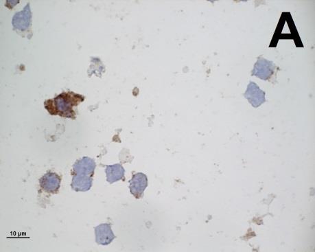 Då immunocytokemi utfördes på mjältutstryk för att fastställa önskvärd koncentration, förbehandling och fixeringsmetod erhölls önskad skärpa på infärgning och tydliga cellkanter då preparaten
