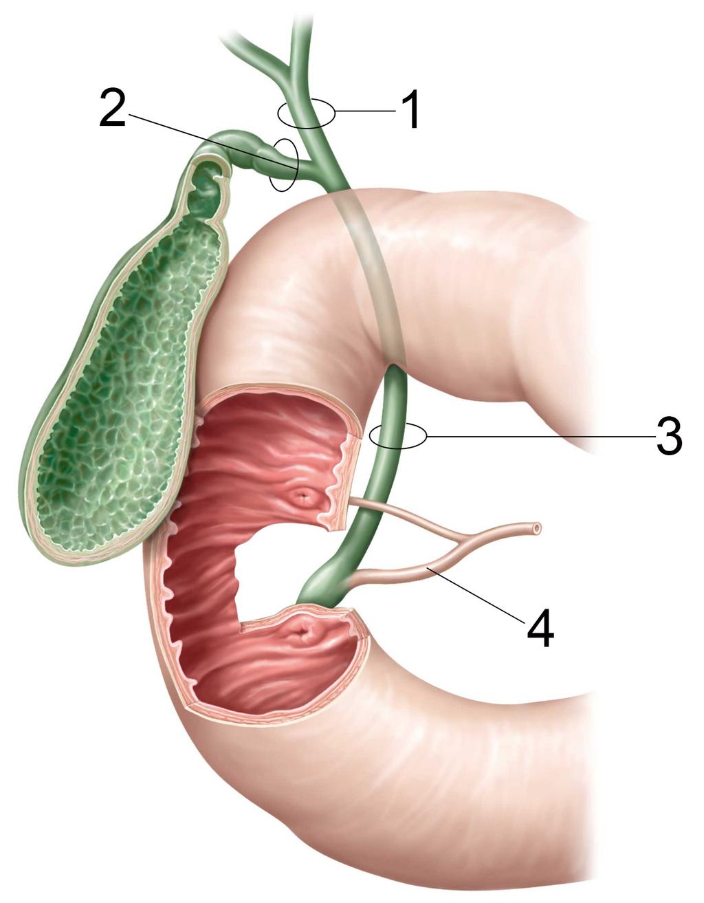 OSOF - Integrerad Tentamen Tema 1-6 2017-06- 14, kl. 09:00-12:00 och 13:00-16:00 Tema 1 Lever Gallblåsa - Pancreas I levern bildas galla (lat. billi; gr.