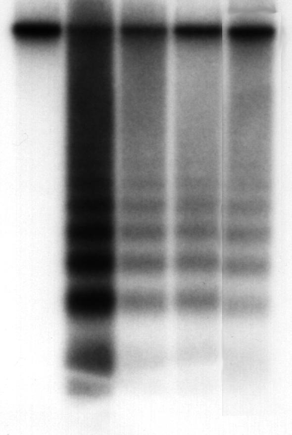 2) Definition av apoptos (programmerad celldöd) sekvens/ordning apoptos och nekros morfologiska kännetecken biokemiska kännetecken Cellular and Molecular Parameters which Distinguish Apoptosis from