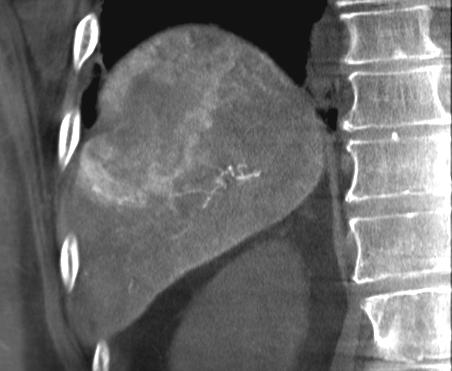 CBCT enligt