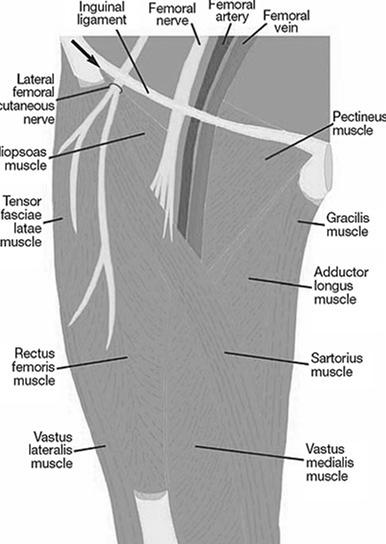 Djupa lager av regio femoris anterior Försök spara så mycket som möjligt av de ytliga strukturerna, framförallt v. saphena magna med tillflöden. Ev.