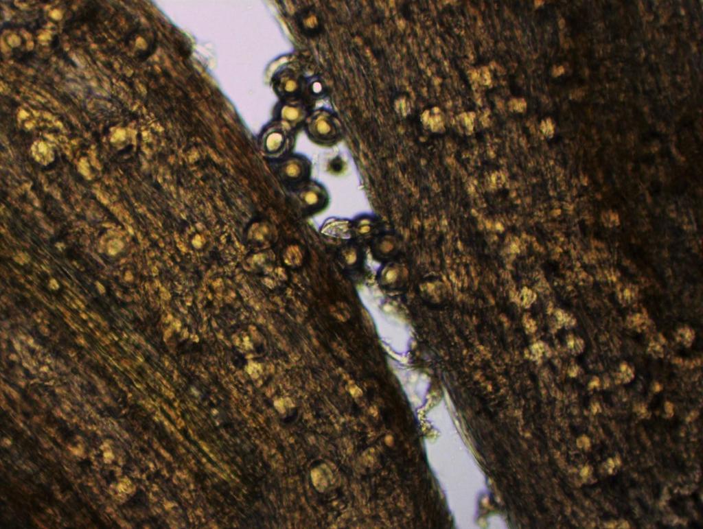17 Figur 7. Bilden visar ett kraftigt angrepp av Aphanomyces euteiches Oosporer på rotvävnaden från en planta med Index 75. Fotografi: P.Finnfors Skillnader mellan serier och försöksled Tabell 5.